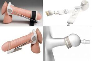 hosszabbítók a pénisz megnagyobbítására